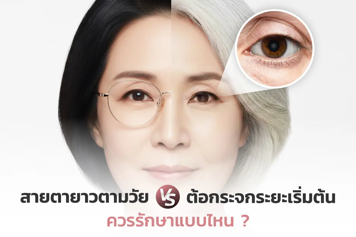  สายตายาวตามวัย vs ต้อกระจกระยะเริ่มต้น: อะไรเหมาะกับเลสิก